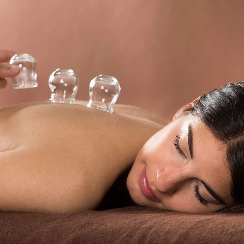 TCM Cupping therapy